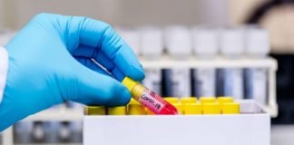 COVID-19-ის 196 ახალი შემთხვევა გამოვლინდა