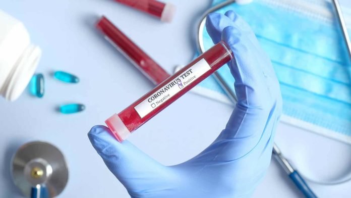 koronavirus-test