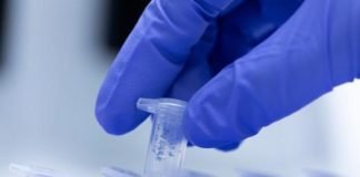 საქართველომ გერმანიისგან საჩუქრად რამდენიმე ათასი PCR ტესტი მიიღო