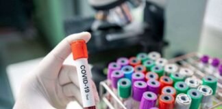 17 თებერვალს კორონავირუსის 400-ზე მეტი შემთხვევა გამოვლინდა