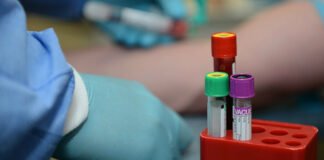 მსოფლიოში „კოვიდ 19“-ის 353 000-ზე მეტი ახალი შემთხვევა გამოვლინდა