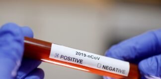 კორონავირუსით კიდევ 43 ადამიანი გარდაიცვალა, დადასტურდა 2016 ახალი შემთხვევა