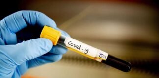 ეპიდვითარება საქართველოში 26 აპრილს