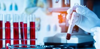 საქართველოში კორონავირუსის 2 185 ახალი შემთხვევა გამოვლინდა