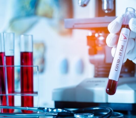 16 აპრილის ეპიდვითარება საქართველოში