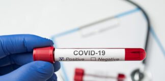 ეპიდვითარება საქართველოში 1-ელ აპრილს