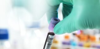 საქართველოში კორონავირუსის 3 567 ახალი შემთხვევა გამოვლინდა