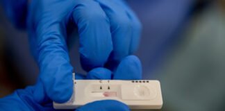 საქართველოში კორონავირუსის 2 228 ახალი შემთხვევა გამოვლინდა