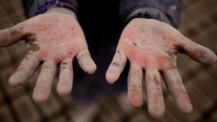 ბავშვთა-შრომა