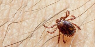 ყირიმ-კონგოს ცხელების კიდევ ერთი შემთხვევა გამოვლინდა