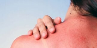 საქართველოში ლეღვის ნახარშით დამწვრობის ორი შემთხვევა დაფიქსირდა