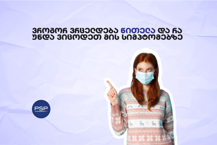 უნივერსალური ზომა_197. წითელა, სტატია1